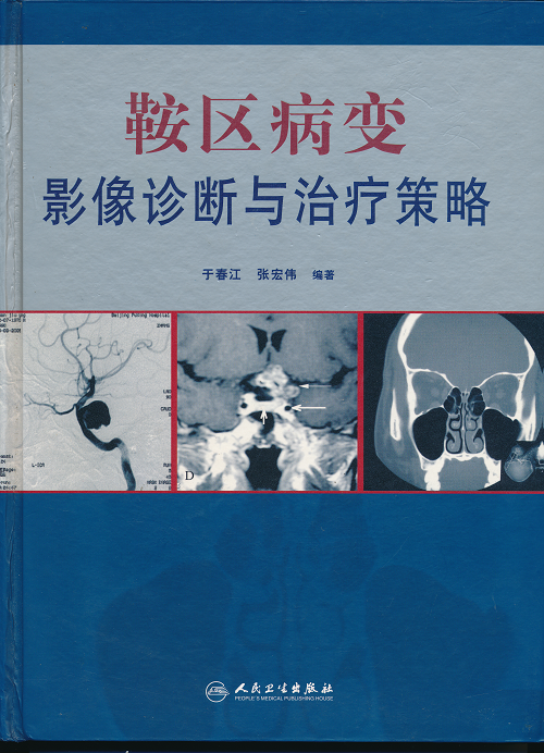 《鞍区病变影像诊断与治疗策略》于春江、张宏伟编著 《鞍区病变影像诊断与治疗策略》于春江、张宏伟编著